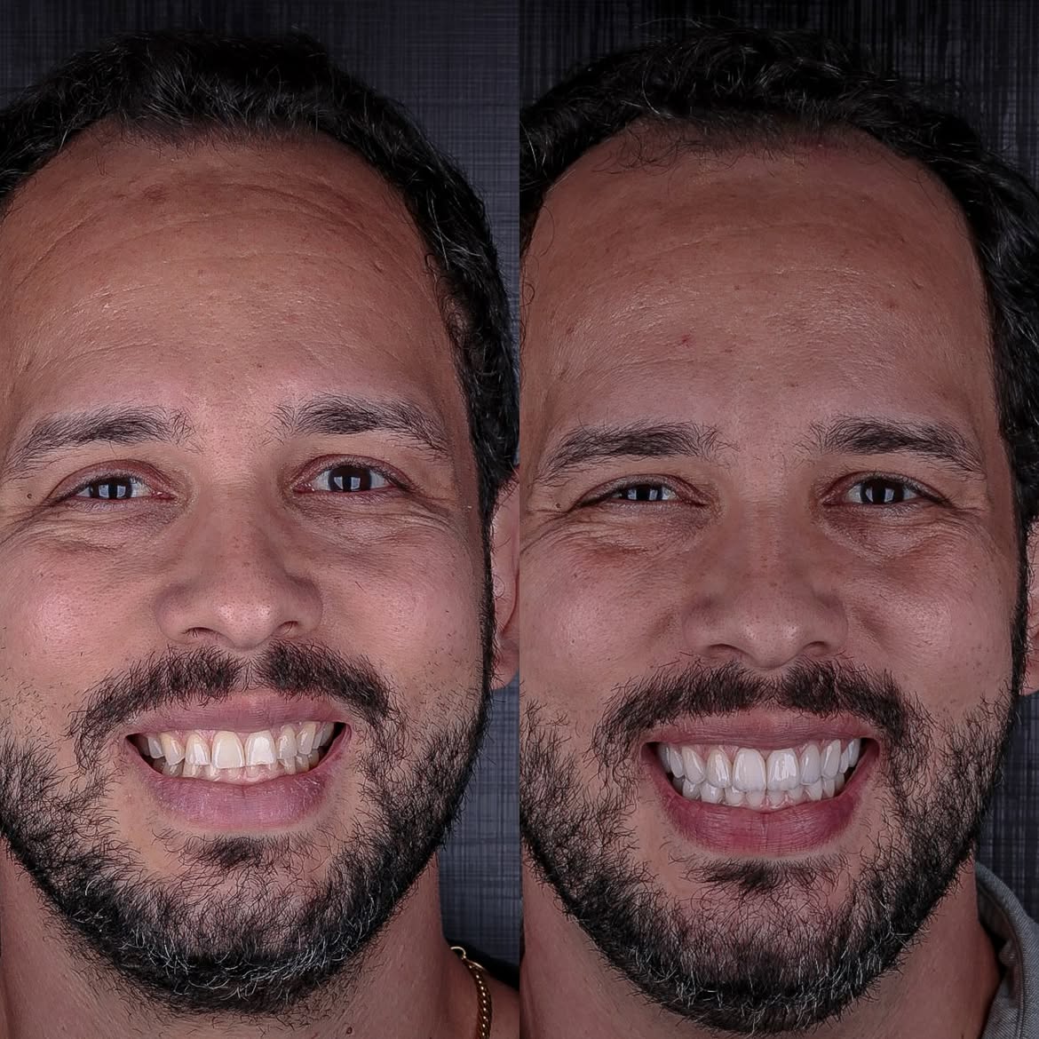 Transformação 1