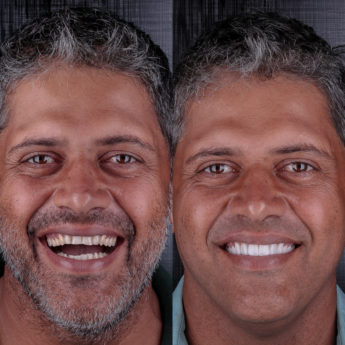 Transformação 5